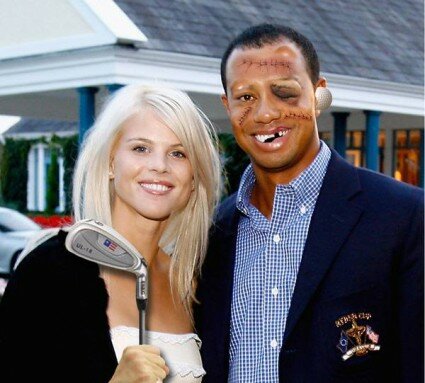 Tiger Woods stitches